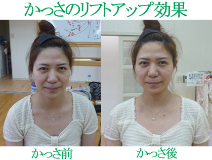 かっさ美容法の小顔 リフトアップ 痩身効果 台湾美容技芸発展協会